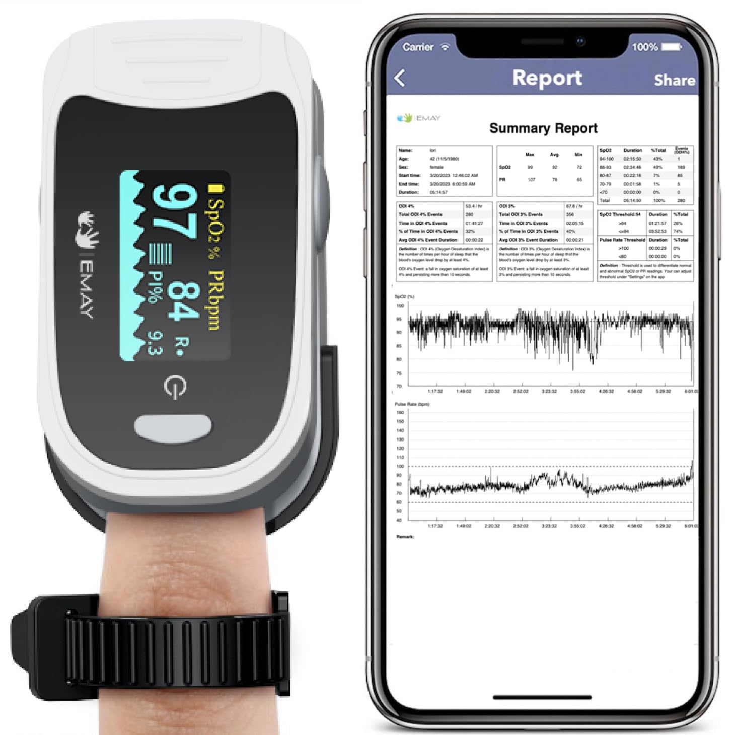 EMAY Sleep Oxygen Monitor with Built-in Recording Capability | Track Continuous...