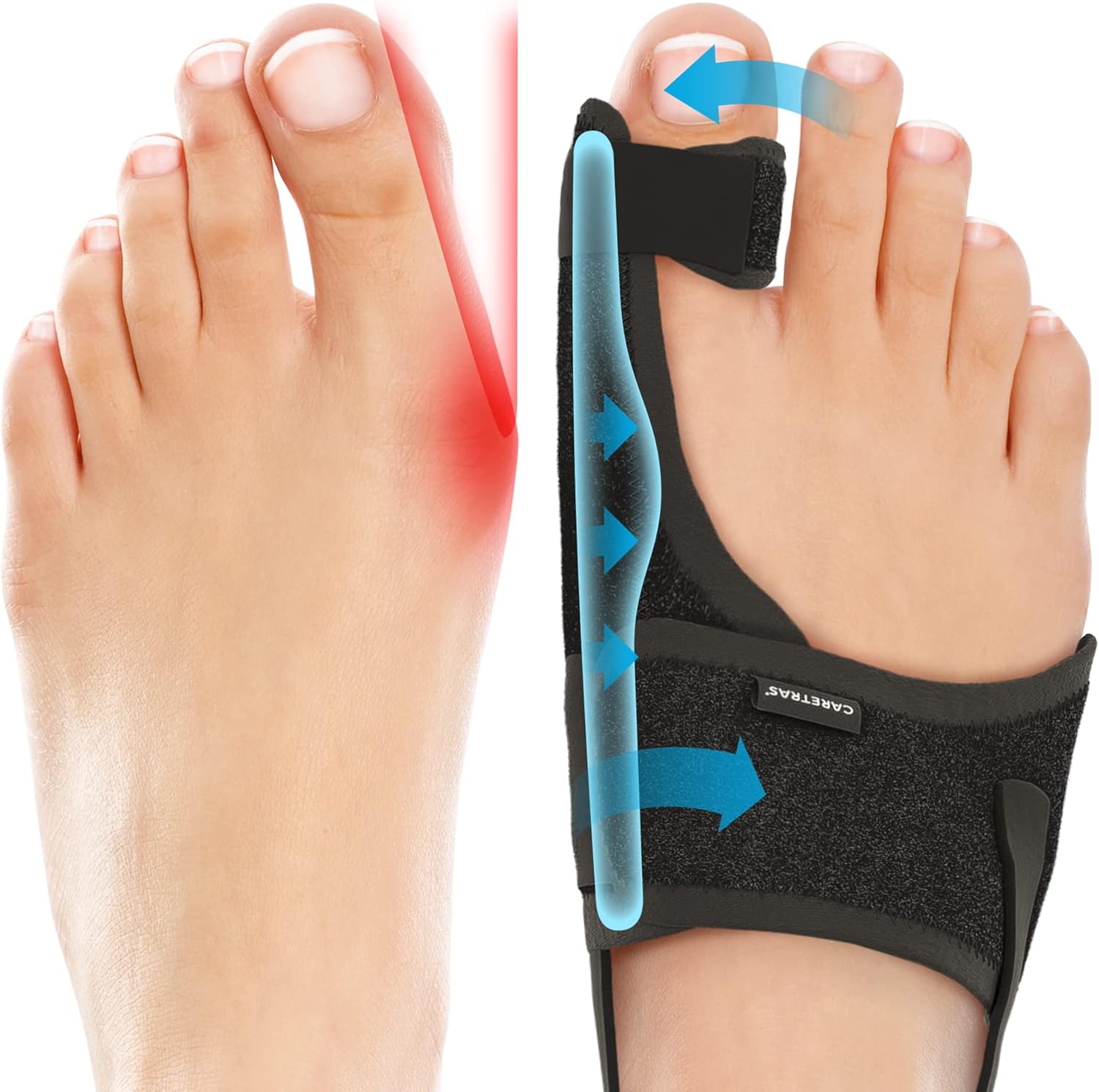 Caretras 2-Pack Bunion Corrector for Women & Men,...