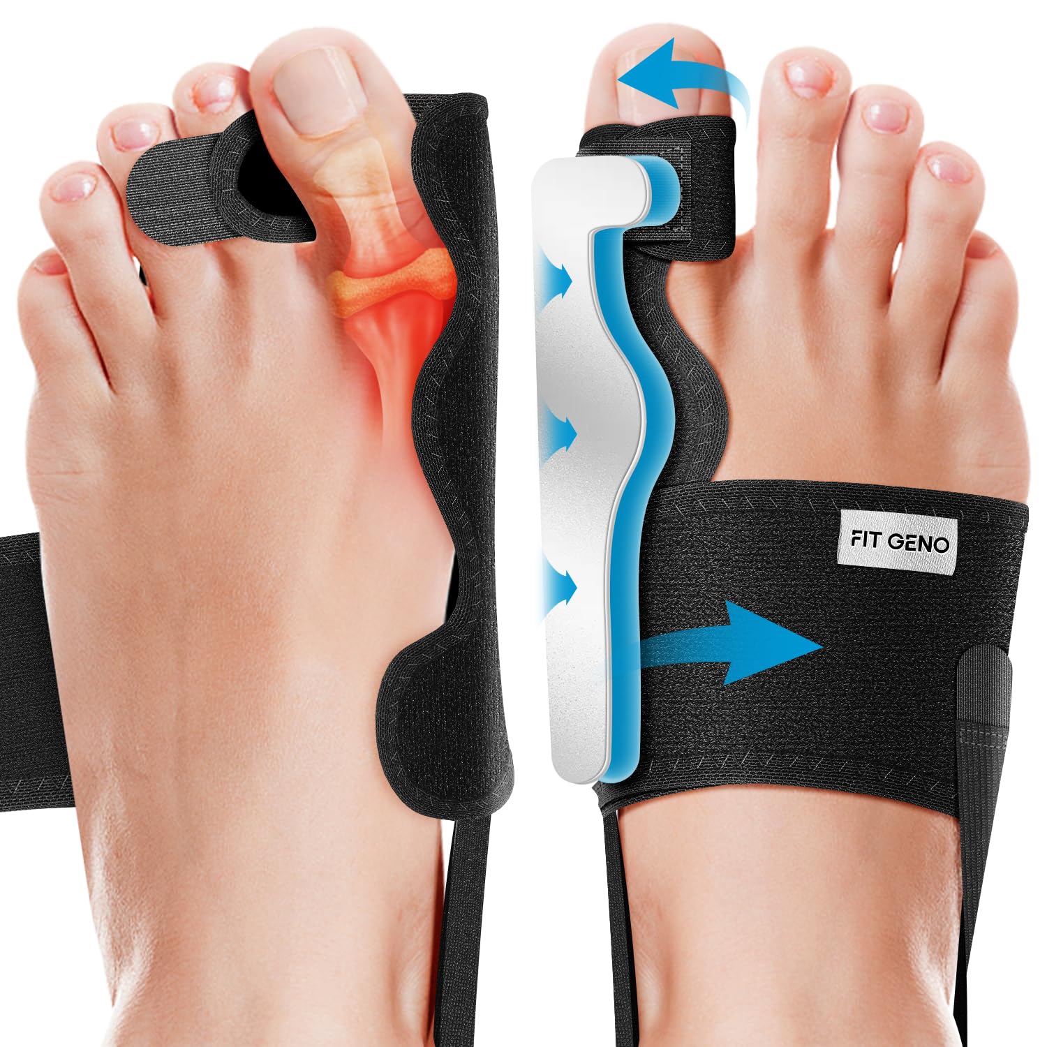 Fitgeno Bunion Corrector Women & Men Big Toe: Foot Straightener Splint Brace - A...