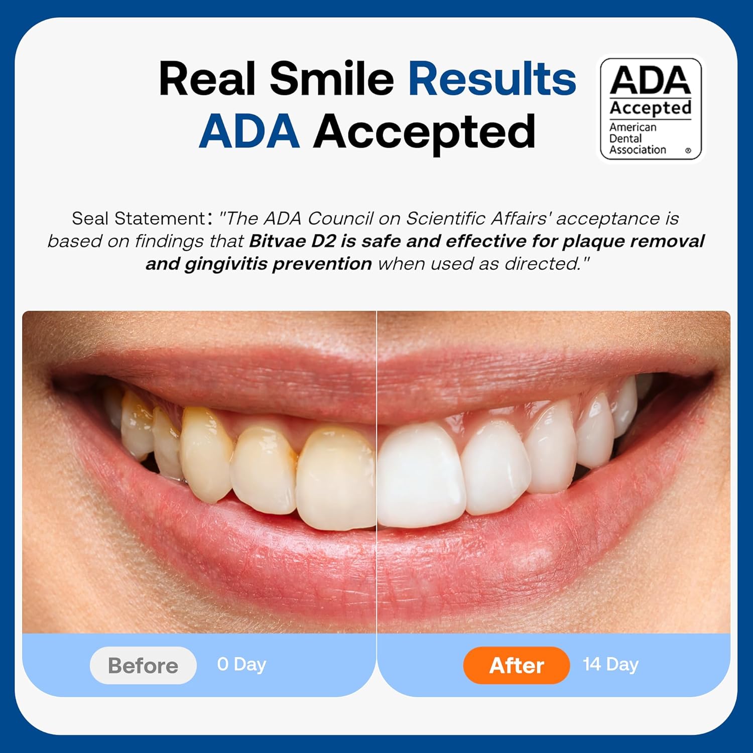 Bitvae D2 Ultrasonic Electric Toothbrush for Adults and Kids, Electric Toothbrus...