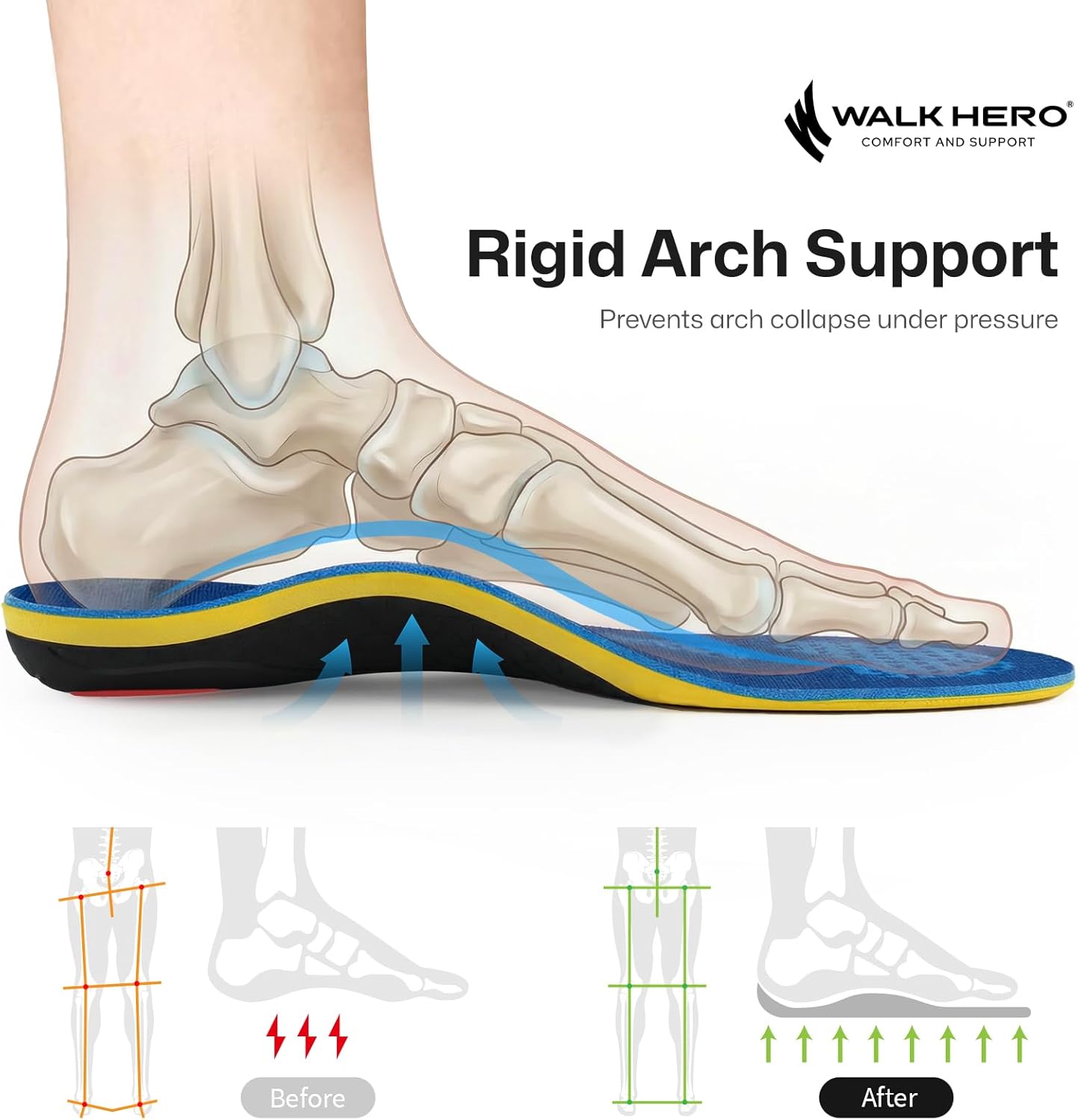 WalkHero High Arch Support Insoles, Special Foot Support for Plantar Fasciitis a...