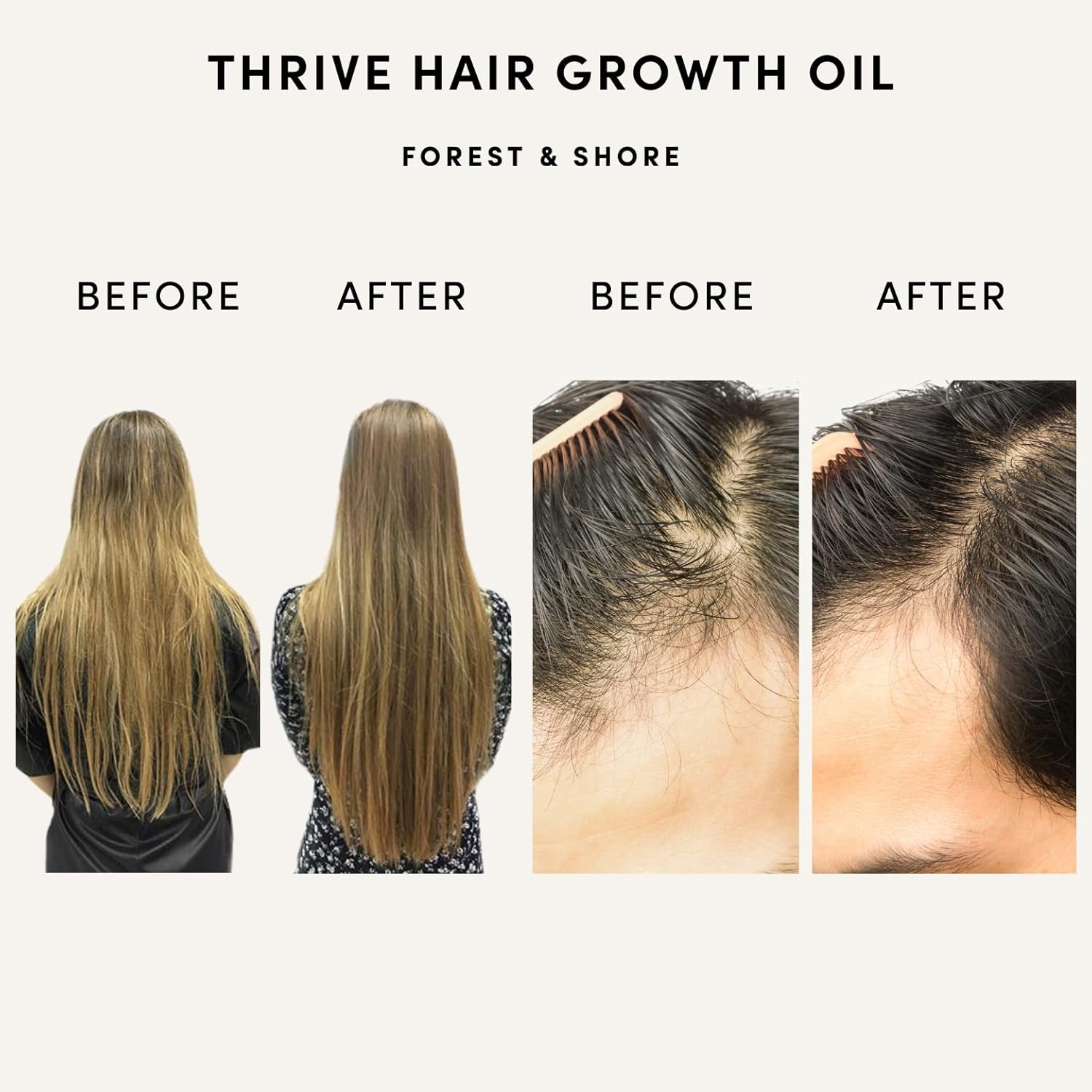 Hair Growth Oil 100% Natural Hair Oil with Caffeine, Biotin, Castor Oil, Argan O...