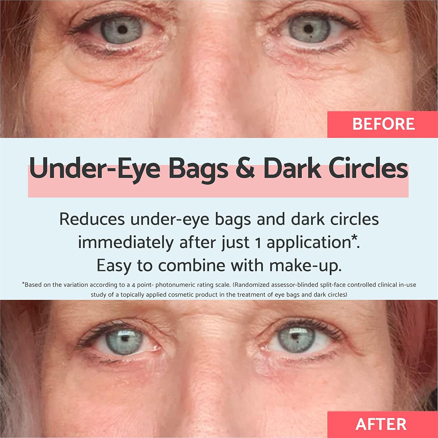 Remescar Eye Bags & Dark Circles 8ml - Instant Dark Circle Eye Cream for Under E...