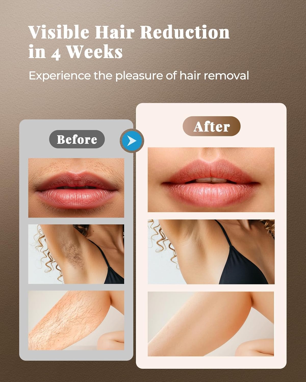 Haarlosy IPL Laser Hair Removal Device for Women and Men with 3-in-1 and Salon Q...