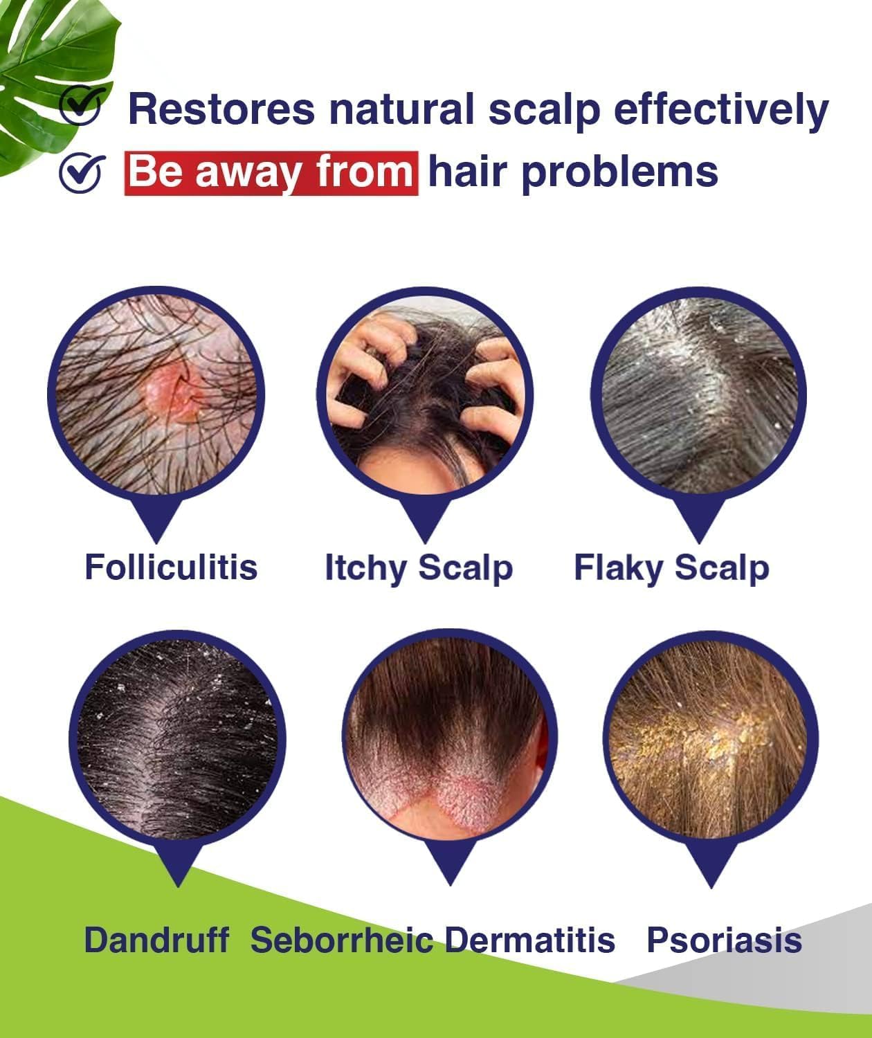 Folliculitis & Seborrheic Dermatitis Shampoo – Anti-Dandruff, Psoriasis & Itchy...